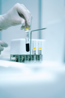 Próbki laboratoryjne